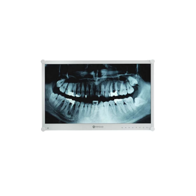 Neovo - Ecran Médical 23,6p Full HD EN60601, IEC60601-1 - Métal Blanc